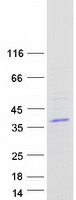 LY6G6F Protein - Purified recombinant protein LY6G6F was analyzed by SDS-PAGE gel and Coomassie Blue Staining