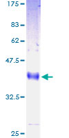 LY6H Protein - 12.5% SDS-PAGE of human LY6H stained with Coomassie Blue