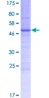 LY6K Protein - 12.5% SDS-PAGE of human LY6K stained with Coomassie Blue
