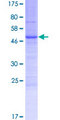 LY6K Protein - 12.5% SDS-PAGE of human LY6K stained with Coomassie Blue