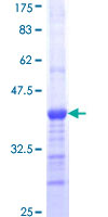 LY9 / CD229 Protein - 12.5% SDS-PAGE Stained with Coomassie Blue.