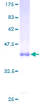 LY96 / MD2 / MD-2 Protein - 12.5% SDS-PAGE of human LY96 stained with Coomassie Blue