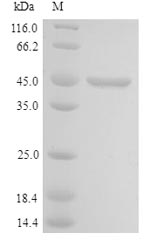 LYAR Protein - (Tris-Glycine gel) Discontinuous SDS-PAGE (reduced) with 5% enrichment gel and 15% separation gel.