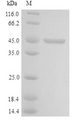 LYAR Protein - (Tris-Glycine gel) Discontinuous SDS-PAGE (reduced) with 5% enrichment gel and 15% separation gel.