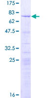 LYAR Protein - 12.5% SDS-PAGE of human LYAR stained with Coomassie Blue