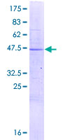 LYG1 Protein - 12.5% SDS-PAGE of human LYG1 stained with Coomassie Blue