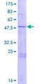 LYG2 Protein - 12.5% SDS-PAGE of human LYG2 stained with Coomassie Blue
