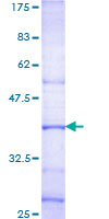 LYN Protein - 12.5% SDS-PAGE Stained with Coomassie Blue.
