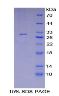 LYN Protein - Recombinant V-Yes-1 Yamaguchi Sarcoma Viral Related Oncogene Homolog By SDS-PAGE