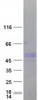 LYN Protein - Purified recombinant protein LYN was analyzed by SDS-PAGE gel and Coomassie Blue Staining