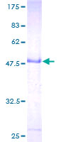 LYPD5 Protein - 12.5% SDS-PAGE of human LYPD5 stained with Coomassie Blue