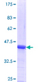 LYPD5 Protein - 12.5% SDS-PAGE Stained with Coomassie Blue.