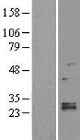LYPLA1 Protein - Western validation with an anti-DDK antibody * L: Control HEK293 lysate R: Over-expression lysate