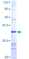 LYPLA1 Protein - 12.5% SDS-PAGE Stained with Coomassie Blue.