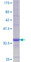 LYPLA1 Protein - 12.5% SDS-PAGE Stained with Coomassie Blue.