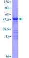 LYPLA2 Protein - 12.5% SDS-PAGE of human LYPLA2 stained with Coomassie Blue