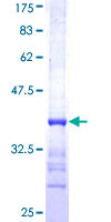 LYPLA2 Protein - 12.5% SDS-PAGE Stained with Coomassie Blue.