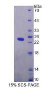 LYPLA2 Protein - Recombinant Lysophospholipase II (LYPLA2) by SDS-PAGE