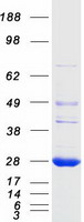 LYPLA2 Protein - Purified recombinant protein LYPLA2 was analyzed by SDS-PAGE gel and Coomassie Blue Staining