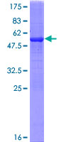 LYPLAL1 Protein - 12.5% SDS-PAGE of human LYPLAL1 stained with Coomassie Blue