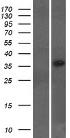 LYSMD2 Protein - Western validation with an anti-DDK antibody * L: Control HEK293 lysate R: Over-expression lysate