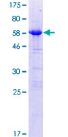 LYSMD2 Protein - 12.5% SDS-PAGE of human LYSMD2 stained with Coomassie Blue