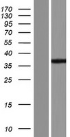 LYSMD3 Protein - Western validation with an anti-DDK antibody * L: Control HEK293 lysate R: Over-expression lysate