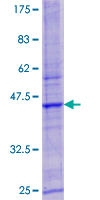 LYSMD3 Protein - 12.5% SDS-PAGE of human LYSMD3 stained with Coomassie Blue