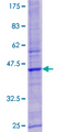 LYSMD3 Protein - 12.5% SDS-PAGE of human LYSMD3 stained with Coomassie Blue