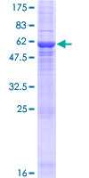 LYSMD4 Protein - 12.5% SDS-PAGE of human LYSMD4 stained with Coomassie Blue
