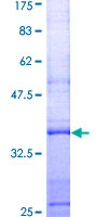 LYZ / Lysozyme Protein - 12.5% SDS-PAGE Stained with Coomassie Blue.