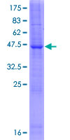 LYZL1 Protein - 12.5% SDS-PAGE of human LYZL1 stained with Coomassie Blue