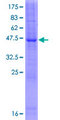 LYZL1 Protein - 12.5% SDS-PAGE of human LYZL1 stained with Coomassie Blue