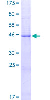 LYZL2 Protein - 12.5% SDS-PAGE of human LYZL2 stained with Coomassie Blue