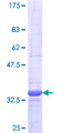 LZTFL1 Protein - 12.5% SDS-PAGE Stained with Coomassie Blue.