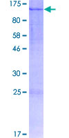 LZTR1 Protein - 12.5% SDS-PAGE of human LZTR1 stained with Coomassie Blue