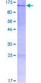 LZTR1 Protein - 12.5% SDS-PAGE of human LZTR1 stained with Coomassie Blue