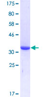 LZTS1 Protein - 12.5% SDS-PAGE Stained with Coomassie Blue.