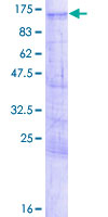 LZTS2 Protein - 12.5% SDS-PAGE of human LZTS2 stained with Coomassie Blue