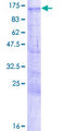 LZTS2 Protein - 12.5% SDS-PAGE of human LZTS2 stained with Coomassie Blue