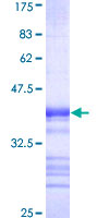 LZTS2 Protein - 12.5% SDS-PAGE Stained with Coomassie Blue.
