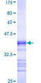 LZTS2 Protein - 12.5% SDS-PAGE Stained with Coomassie Blue.