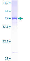 M-PST / STM Protein - 12.5% SDS-PAGE of human SULT1A3 stained with Coomassie Blue