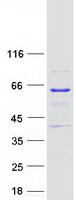 M1AP Protein - Purified recombinant protein M1AP was analyzed by SDS-PAGE gel and Coomassie Blue Staining