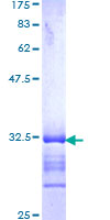 M6PR Protein - 12.5% SDS-PAGE Stained with Coomassie Blue.