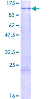 MAATS1 Protein - 12.5% SDS-PAGE of human C3orf15 stained with Coomassie Blue