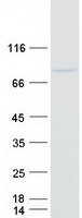 MAATS1 Protein - Purified recombinant protein MAATS1 was analyzed by SDS-PAGE gel and Coomassie Blue Staining