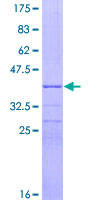 MAB21L1 Protein - 12.5% SDS-PAGE Stained with Coomassie Blue.