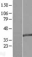 MAB21L2 Protein - Western validation with an anti-DDK antibody * L: Control HEK293 lysate R: Over-expression lysate