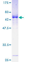 MAB21L2 Protein - 12.5% SDS-PAGE of human MAB21L2 stained with Coomassie Blue